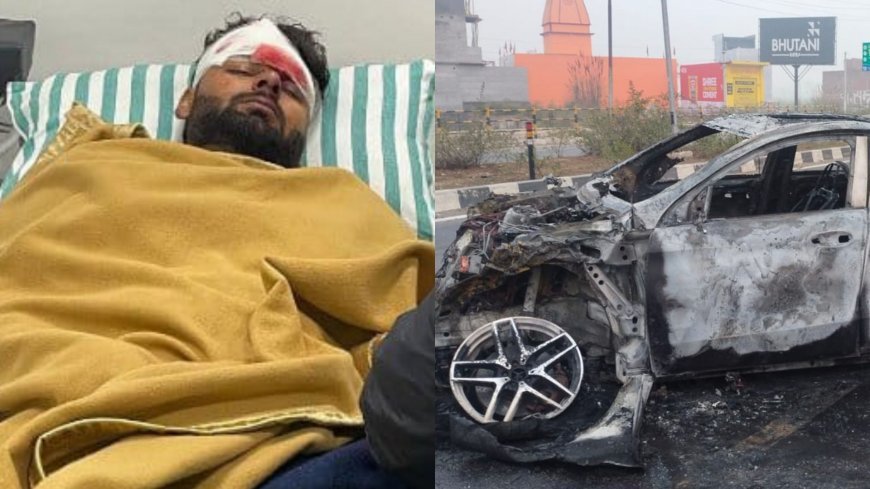 Rishabh Pant Accident: ऋषभ पंत की कार का भीषण एक्सीडेंट, सिर और पीठ समेत कई जगह गंभीर चोटें